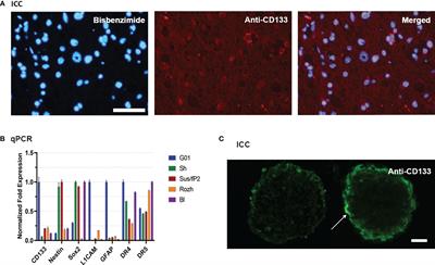 A Combined Effect of G-Quadruplex and Neuro-Inducers as an Alternative Approach to Human Glioblastoma Therapy